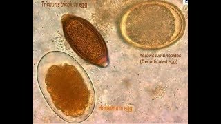 parasites seen from the microscope [upl. by Bevvy]