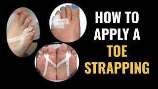 How Do I Do Toe Strapping Dislocated and Fractured Toe [upl. by Iow]