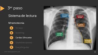 Tutorial Radiografía de Torax [upl. by Petulia]