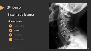 Radiografía de Columna Paso a Paso [upl. by Idnim]