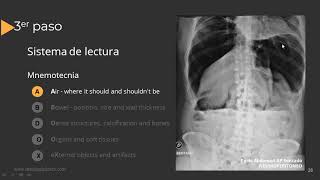 Radiografía de Abdomen Paso a Paso [upl. by Jezrdna961]