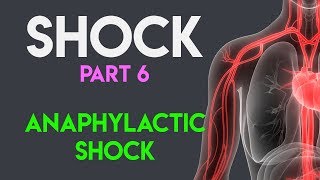 Anaphylactic Shock  Shock Part 6 [upl. by Neille620]