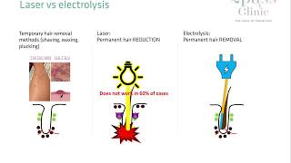 Laser hair removal vs Electrolysis [upl. by Etnad]