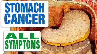 Stomach Cancer  All Symptoms [upl. by Phia417]