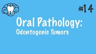 Oral Pathology  Odontogenic Tumors  INBDE ADAT [upl. by Enyrhtac922]