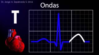 Electrocardiografía Básica Parte 14 [upl. by Audwen]