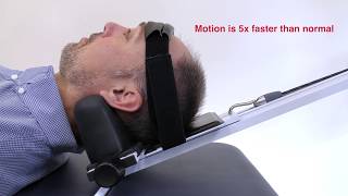 Neck Decompression Machine  Cervical Mechanical Traction [upl. by Dion]