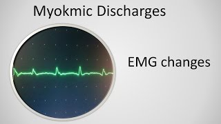 Myokymia on EMG [upl. by Keavy31]