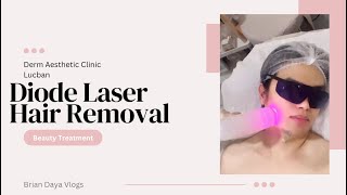 Diode Hair Laser Removal [upl. by Hsac470]