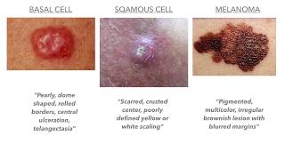 Dermatology on USMLECOMLEX [upl. by Terhune383]