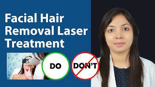 Facial Hair Removal Using Laser  Side Effects of Laser Hair Removal of Face  Dos and Donts [upl. by Harshman]