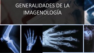 Generalidades de la Imagenología Rx US TAC y RM [upl. by Eldnik]