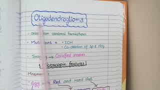 CNS Tumors  Robbins Pathology [upl. by Emmanuel209]