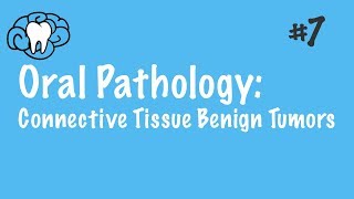 Oral Pathology  Connective Tissue Benign Tumors  INBDE ADAT [upl. by Octavius]